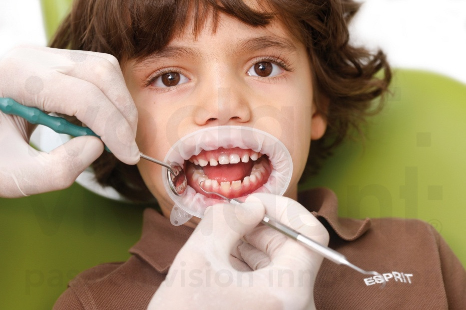 OptraGate Refill Small Pack of 80 thumbnail 6