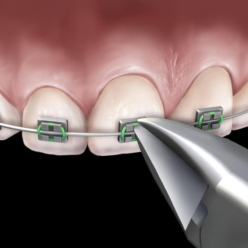 Distal End Cutter Micro Slim Cut Ea thumbnail 21