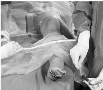 Rear Pivot Assistant’s Instrumentation product image