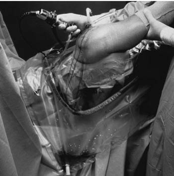 Steri-Drape 47x70" Sterile Surgical/Neurology/Orthopedic Drape Fenestrated product image