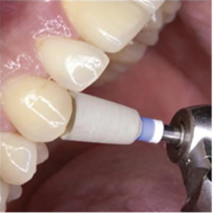 Rubberized Abrasive Cone - Bullet 1-1/2" x 1" - Green Med S/C thumbnail 3