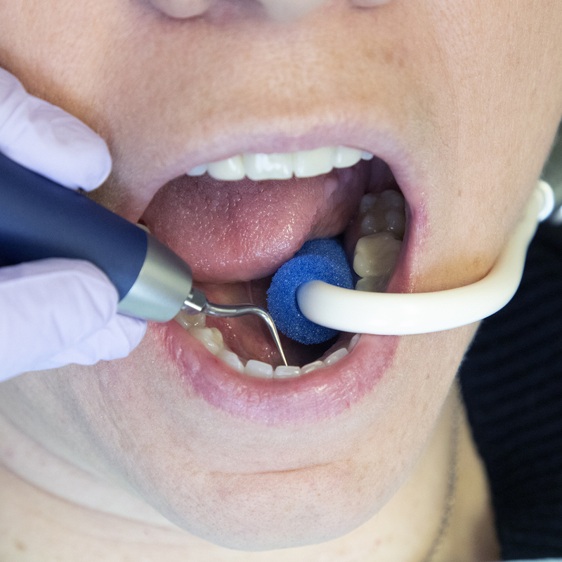 Saliva Ejector Foam-Tip Cushions, Disposable, 1", Blue, 100/Pk, 50Z970 thumbnail 11