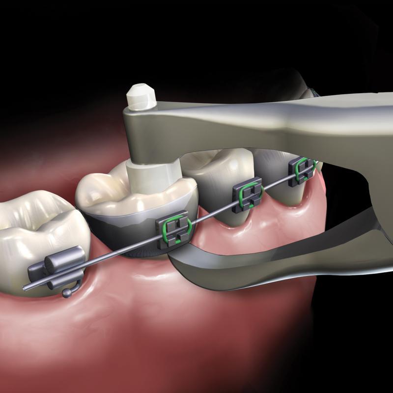 Band Remover Pliers Posterior Tapered Ea product image