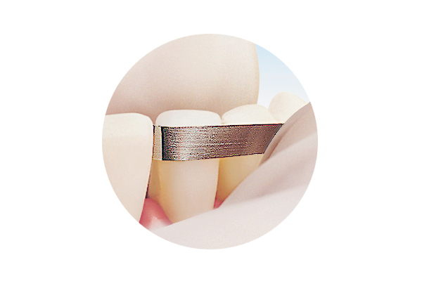 Compo-Strip 200T2 for Orthodontic Reproximation, Double-Sided, 4 mm, 3/Pk, 2013180 thumbnail 11