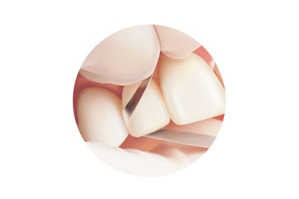 Compo-Strip Diamond Finishing Strips, Single-Sided, 100UF, 2.5 mm, 20 Micron, Yellow, 6/Pk, 2013115 thumbnail 12