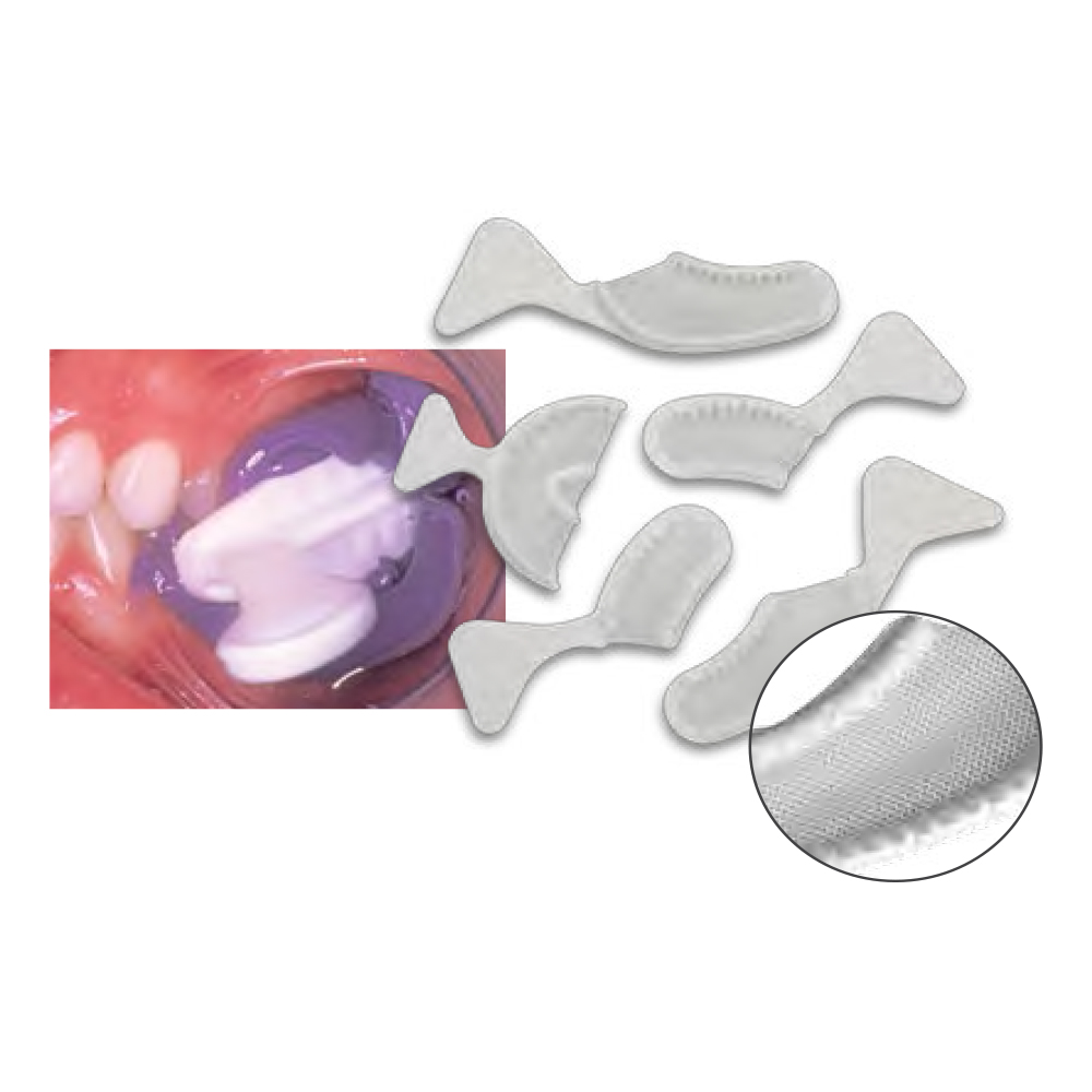 Impression Tray 40/Bx thumbnail 2
