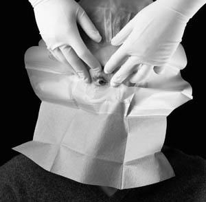 3M STERI-DRAPE OPHTHALMIC SURGICAL DRAPES 1055B product image