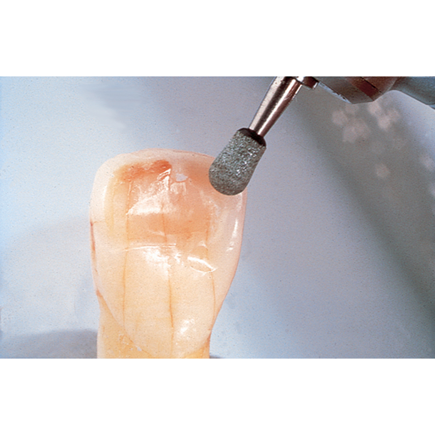 Dura-Green Stones, FG, Round, # 024 (RD2), Green, 12/Pk, 0108 thumbnail 11